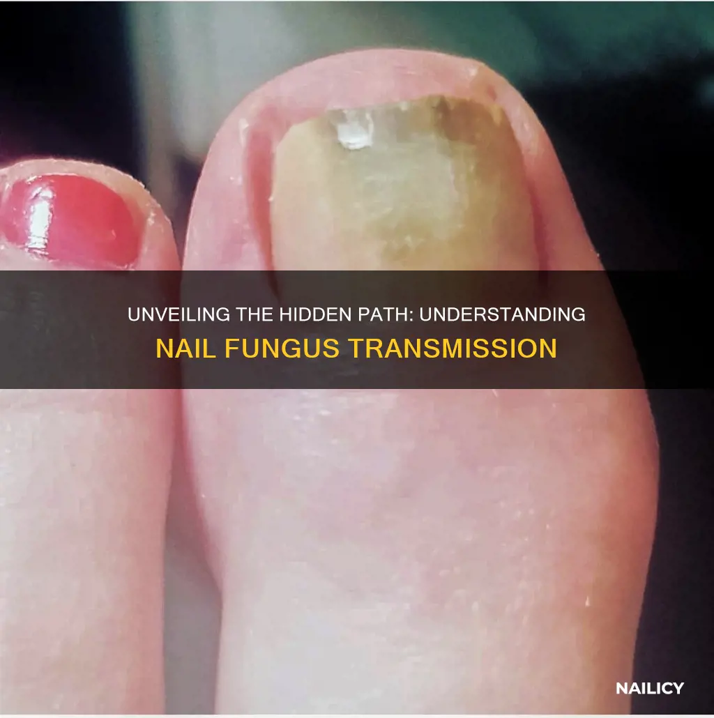 how does finger nail fungus spread