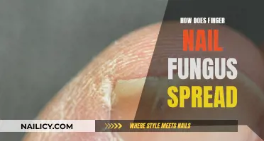 Fungal Infections: How Nail Fungus Spreads and Grows