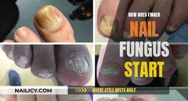 Unveiling the Mystery: How Nail Fungus Begins