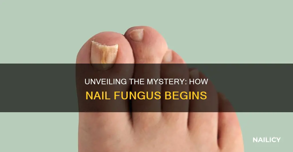 how does finger nail fungus start