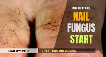 Fingernail Fungus: Causes and Origins Explained