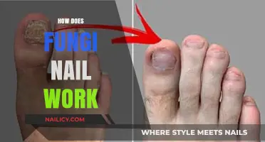 Understanding Fungi Nail: How This Treatment Works to Clear Infections