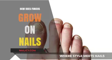 Fungus on Nails: Causes and Growth Factors