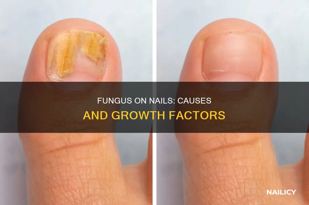 how does fungus grow on nails