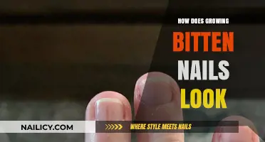 Biting Nails: What Does It Do to Your Nails?