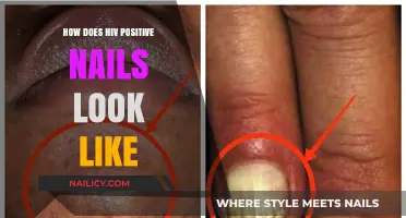 Identifying HIV-Related Nail Changes: Appearance, Symptoms, and Care Tips