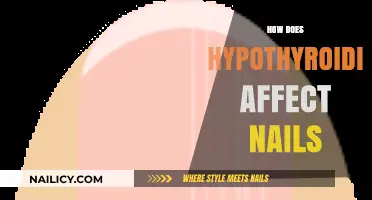 Hypothyroidism and Nail Health: Understanding Symptoms, Changes, and Care