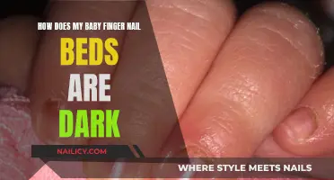 Baby's Dark Fingernail Beds: What Parents Should Know