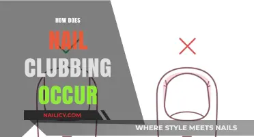 Understanding Nail Clubbing: Causes, Symptoms, and Underlying Health Conditions