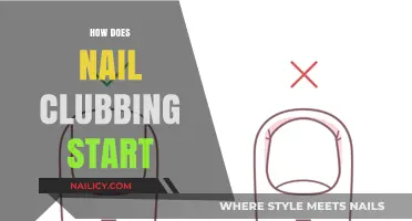 Understanding Nail Clubbing: Causes, Early Signs, and Development Process