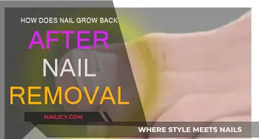 Regrowing Nails: What to Expect After Nail Removal