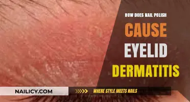 Nail Polish and Eyelid Dermatitis: Uncovering the Unexpected Connection