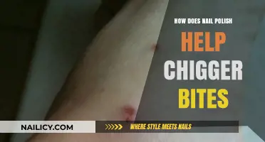 Nail Polish Remedy: Soothing Chigger Bites with a Quick Fix