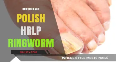 Nail Polish as Ringworm Remedy: Surprising Benefits and How It Works