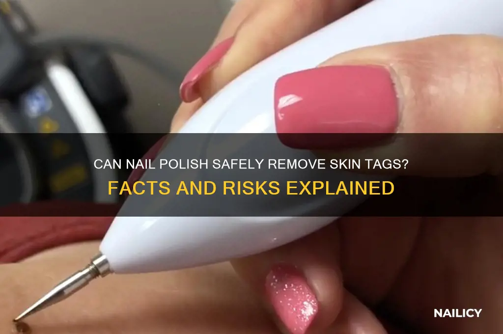 how does nail polish kill skin tags