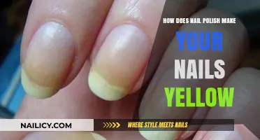 Why Nail Polish Causes Yellow Nails: Prevention and Solutions Explained