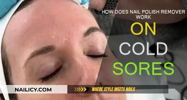 Nail Polish Remover: Cold Sore Treatment or Myth?