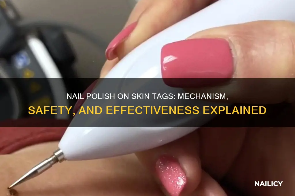 how does nail polish work on skin taggs