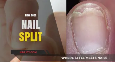 Understanding Nail Splitting: Causes, Prevention, and Effective Treatment Tips