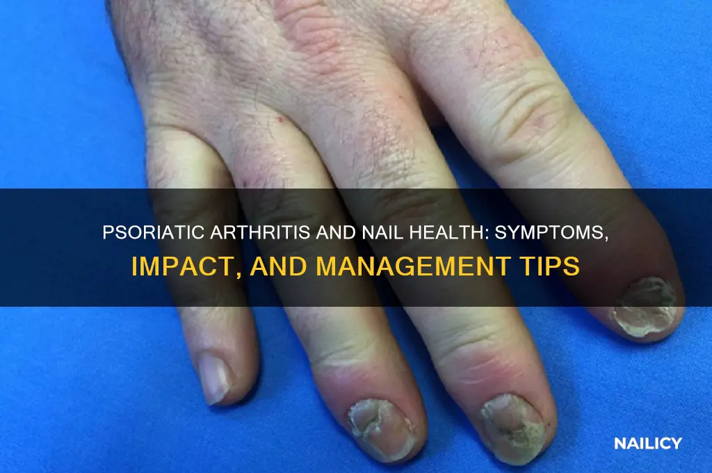how does psoriatic arthritis affect your nails