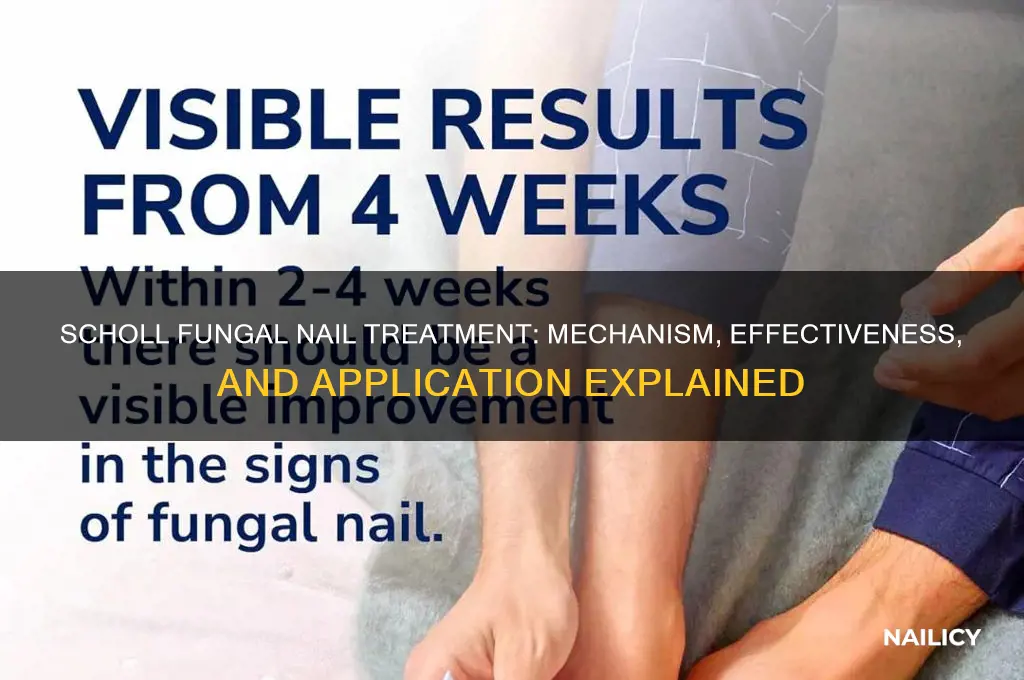 how does scholl fungal nail treatment work