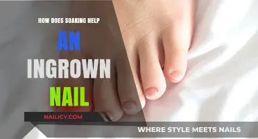 Soothing Relief: How Soaking Eases Painful Ingrown Toenails Effectively