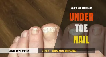Unveiling the Mysteries: How Stuff Gets Under Your Toenail