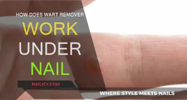Wart Remover Under Nails: How Does It Work?