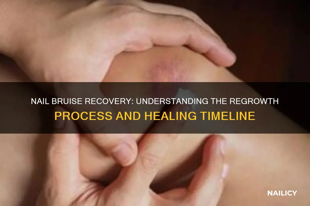 how does your nail regrow after its bruised