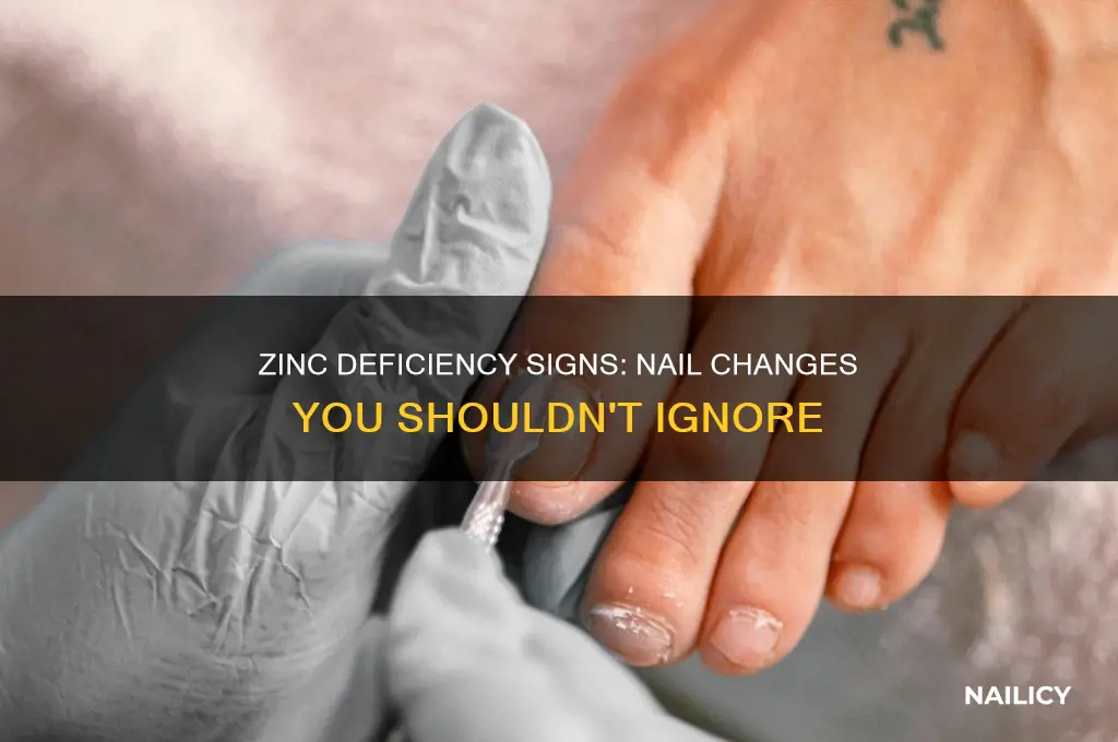 how does zinc deficiency show on nails