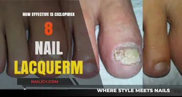 Ciclopirox 8% Nail Lacquer: Effectiveness in Treating Fungal Infections