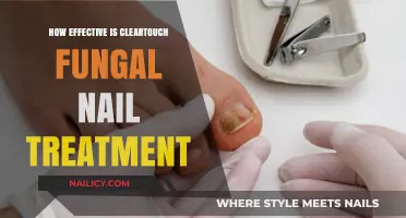 Cleartouch Fungal Nail Treatment: Real Results or Just a Myth?