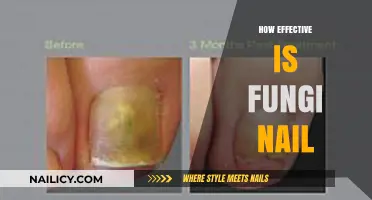 Fungi Nail Treatment: Effectiveness, Results, and User Experiences Explored