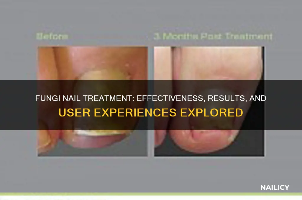 how effective is fungi nail