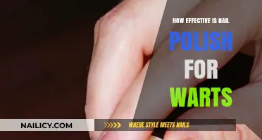 Nail Polish for Warts: A Surprising Home Remedy's Effectiveness Explored