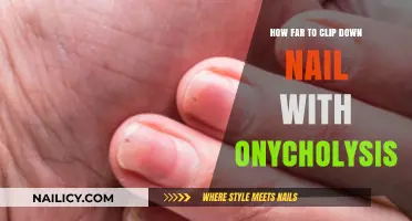Nail Clipping Tips: Safely Managing Onycholysis Without Further Damage