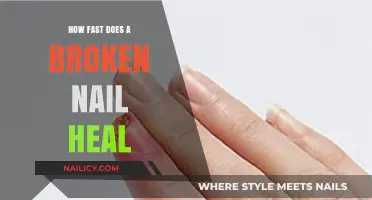 Speedy Recovery: How Fast Does a Broken Nail Heal?