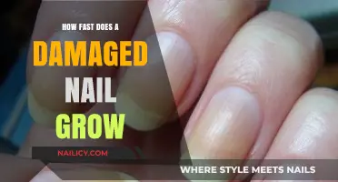Damaged Nail Recovery: How Fast Does it Grow Back?