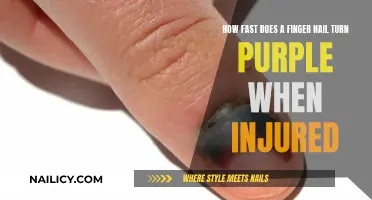 Injured Fingernail: Purple and Healing Timeline