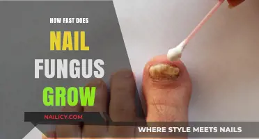 The Rapid Growth of Nail Fungus