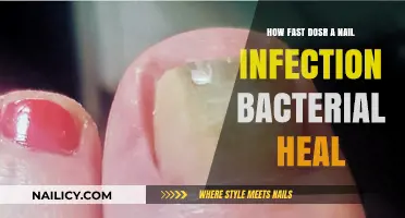 Speedy Recovery: How Fast Do Bacterial Nail Infections Heal?