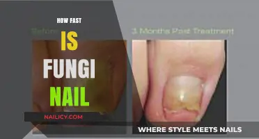 Fungi Nail Speed: How Quickly Does It Work for Toenail Fungus?