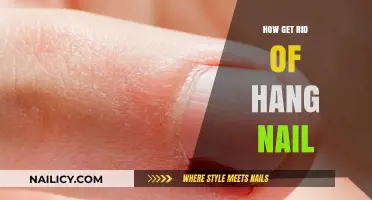 Say Goodbye to Hangnails: Effective Remedies for Quick Relief