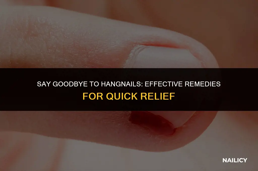 how get rid of hang nail