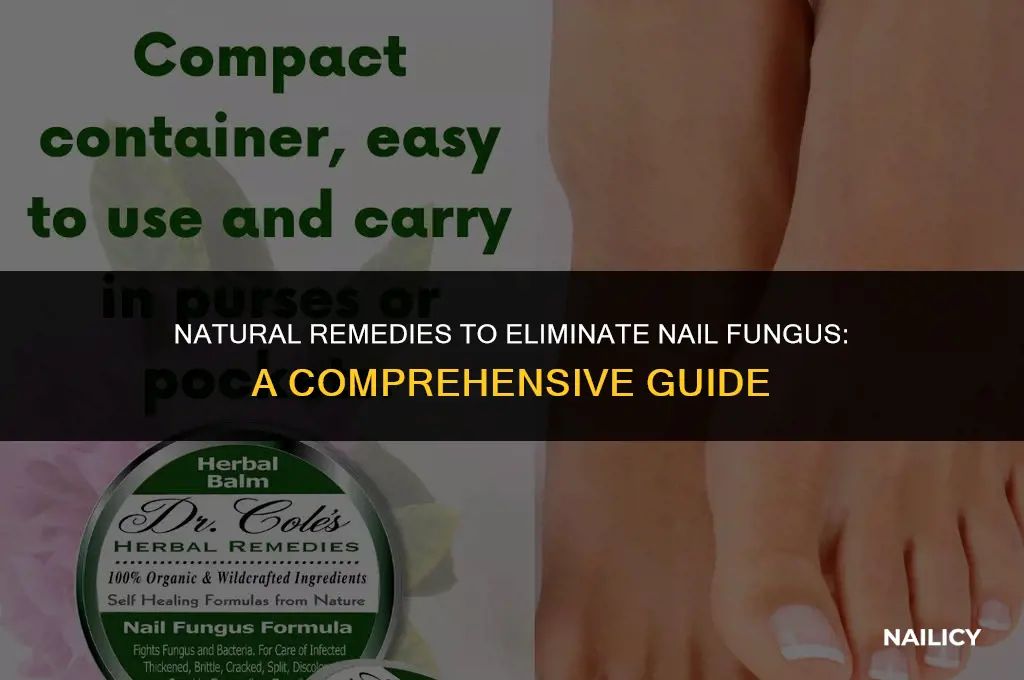how get rid of nail fungus naturally