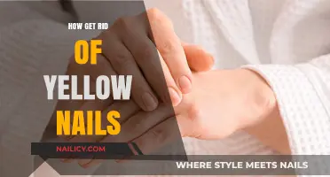 Banish Yellow Nails: A Comprehensive Guide to Healthy, Beautiful Hands