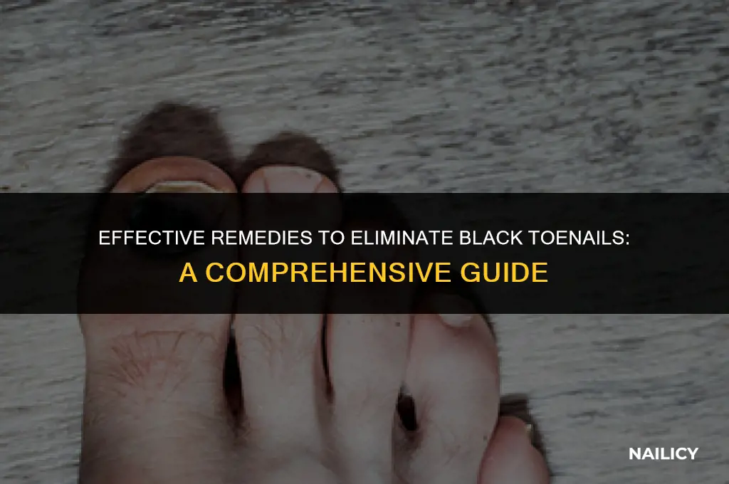 how go get rid of a black toe nail