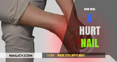Quick Tips to Soothe and Repair a Painful Injured Nail
