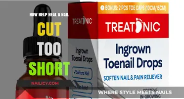 Quick Fixes for Nails Cut Too Short