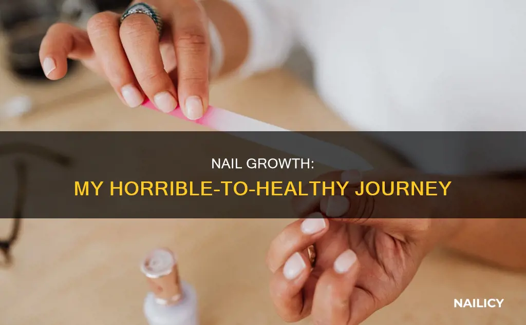 how i grow my horrible nails